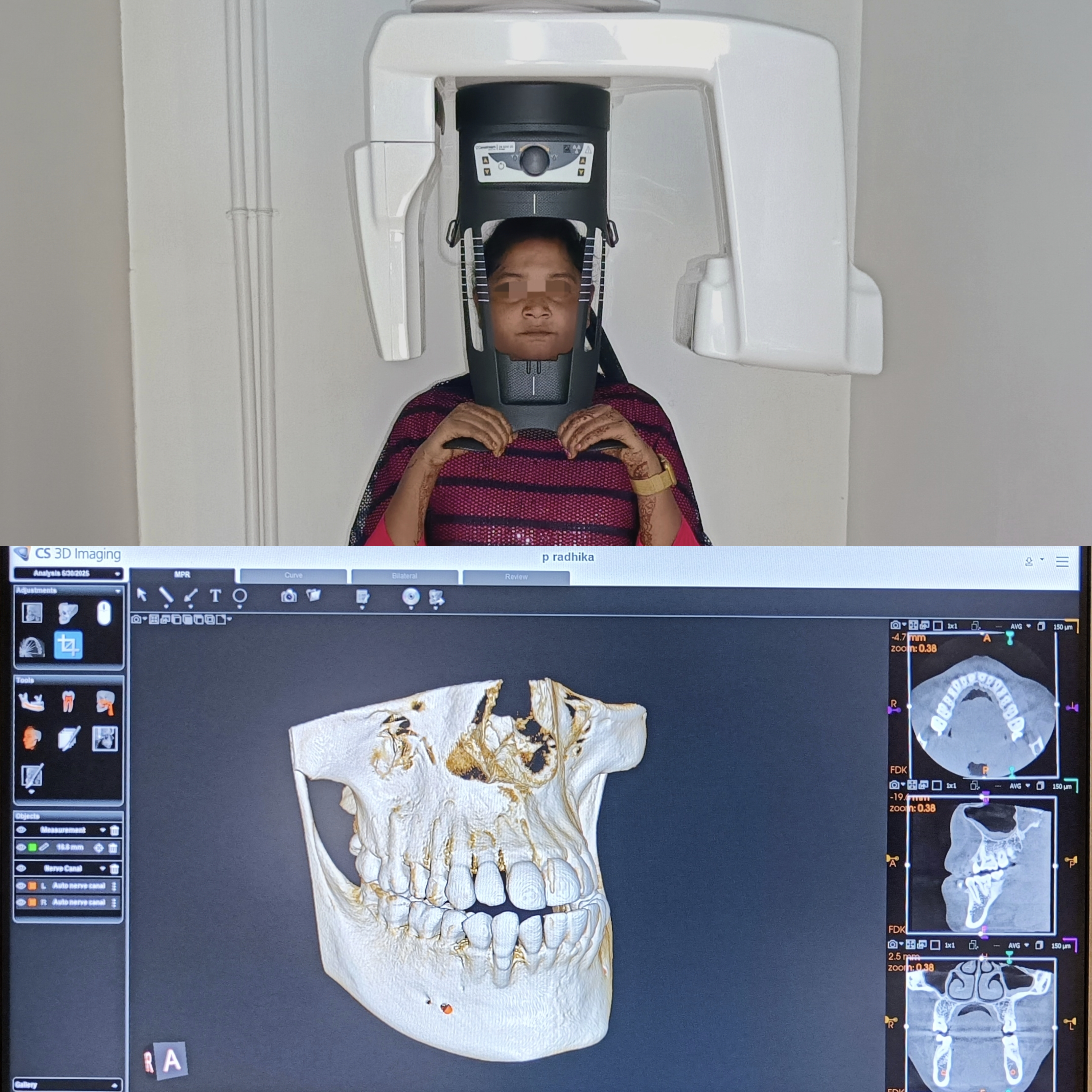 CBCT 3D Dental Imaging