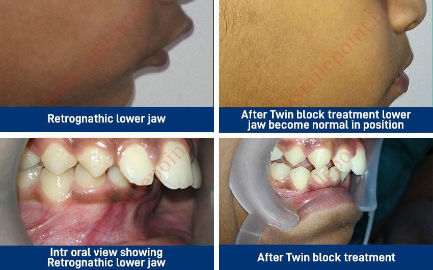 Child Care Dentistry